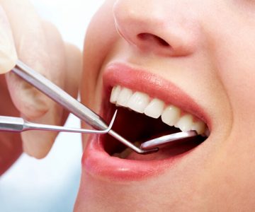 Nhổ răng tại nha khoa Ngân Phượng