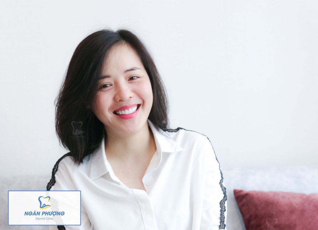 răng sứ có được bảo hành? câu trả lời là chắc chắn có