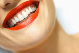 Răng Sứ Có Được Bảo Hành Lâu Không?