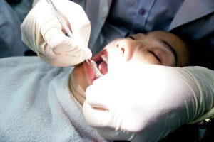 một người được vệ sinh răng bằng chỉ nha khoa