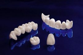 Các Loại Răng Sứ Phổ Biến Hiện Nay