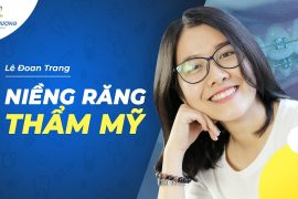 Niềng Răng Thay Đổi Nhiều Thứ