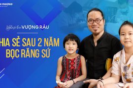 Danh Hài Vượng Râu – Chia sẻ sau 2 năm bọc răng sứ