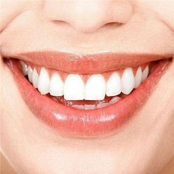 HT SMILE CÓ TỐT KHÔNG – GIẢM GIÁ CHỈ CÒN 3.5TR/ RĂNG