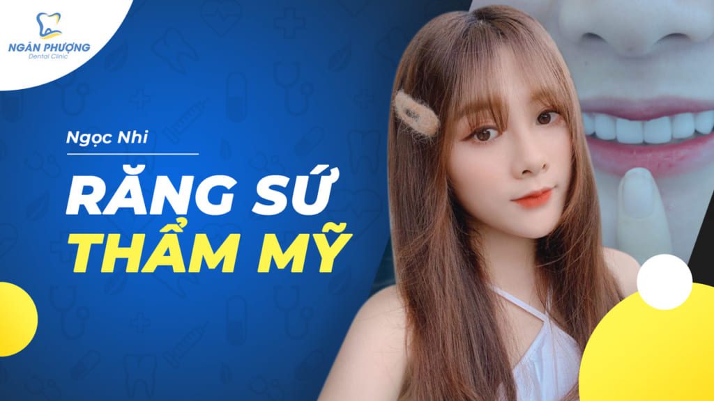 ngọc nhi đến ngân phượng làm răng sứ