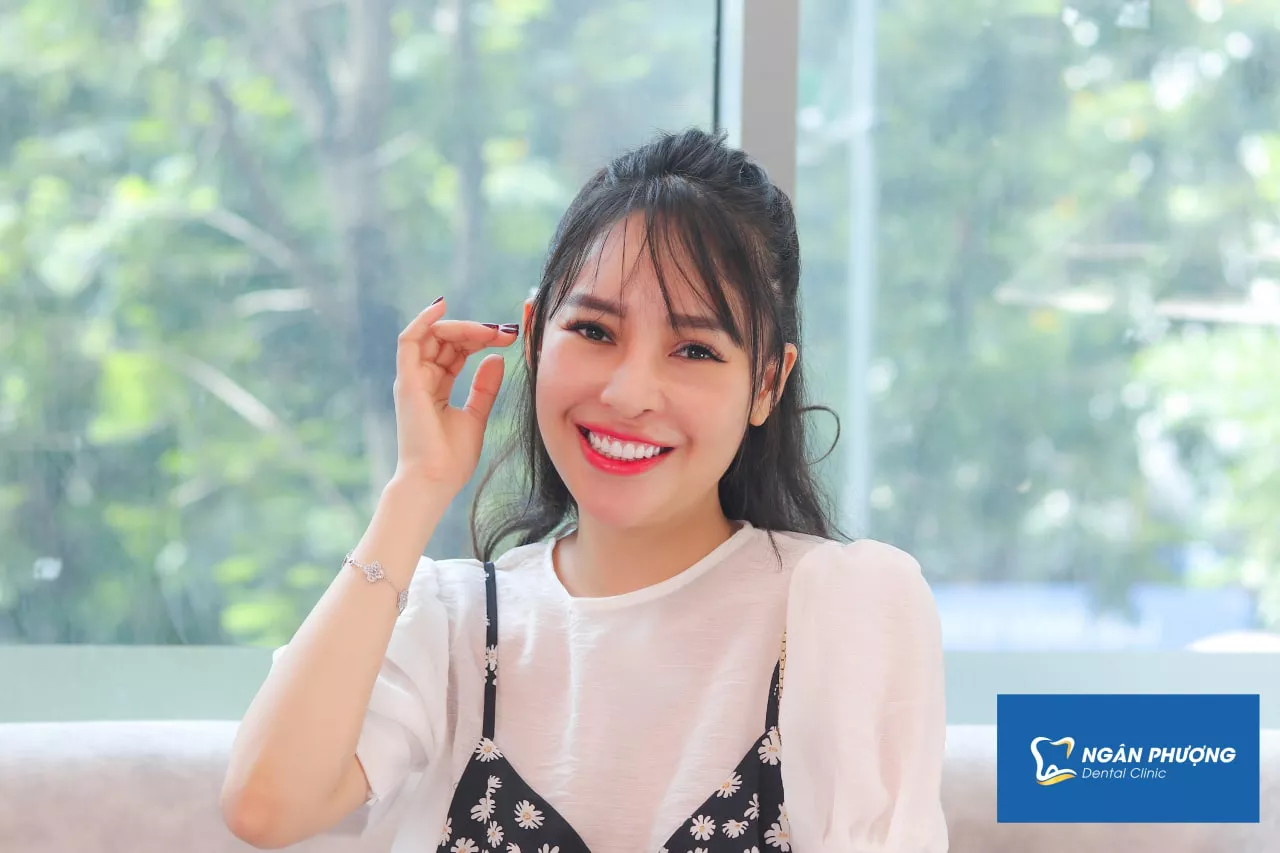 một người nữ cười tươi với răng sứ