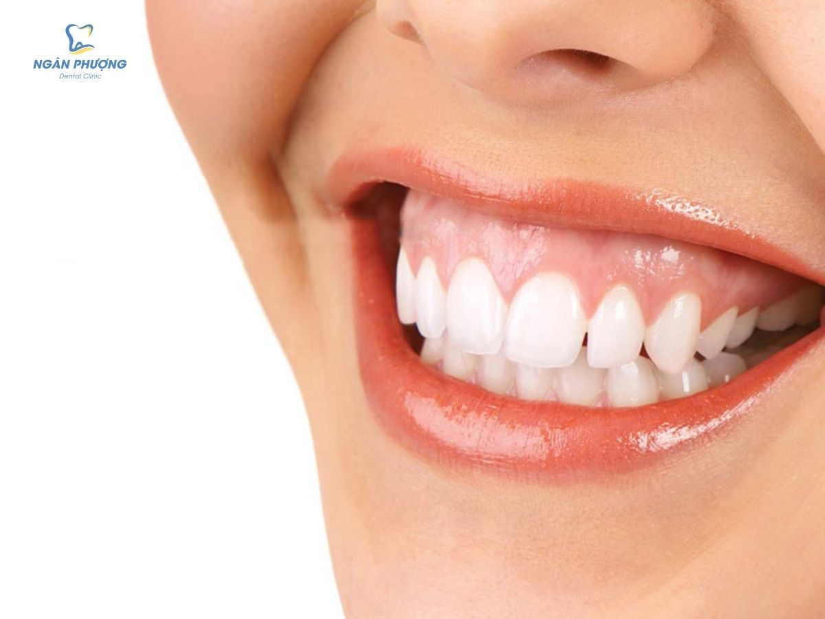 tướng số người cười hở lợi