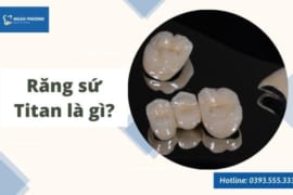 RĂNG SỨ TITAN LÀ GÌ? ƯU, NHƯỢC ĐIỂM CỦA RĂNG SỨ TITAN