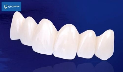 răng toàn sứ bao nhiêu tiền