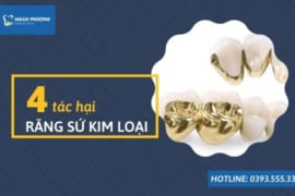4 TÁC HẠI CỦA RĂNG SỨ KIM LOẠI-KHÁCH HÀNG KHÔNG NÊN CHỦ QUAN