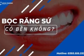 BỌC RĂNG SỨ CÓ BỀN KHÔNG? 7 MẸO TĂNG TUỔI THỌ RĂNG SỨ MÀ BẠN NÊN THỬ