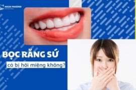 BỌC RĂNG SỨ CÓ BỊ HÔI MIỆNG KHÔNG? CÁCH KHẮC PHỤC TÌNH TRẠNG NÀY?