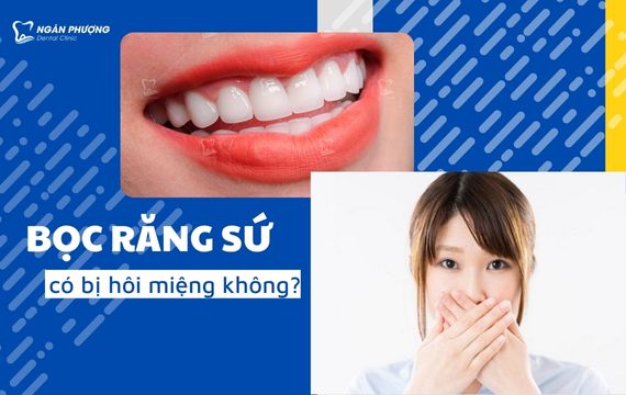 bọc răng sứ có bị hôi miệng không