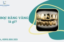 BỌC RĂNG VÀNG LÀ GÌ? CÓ NÊN BỌC RĂNG VÀNG HAY KHÔNG?