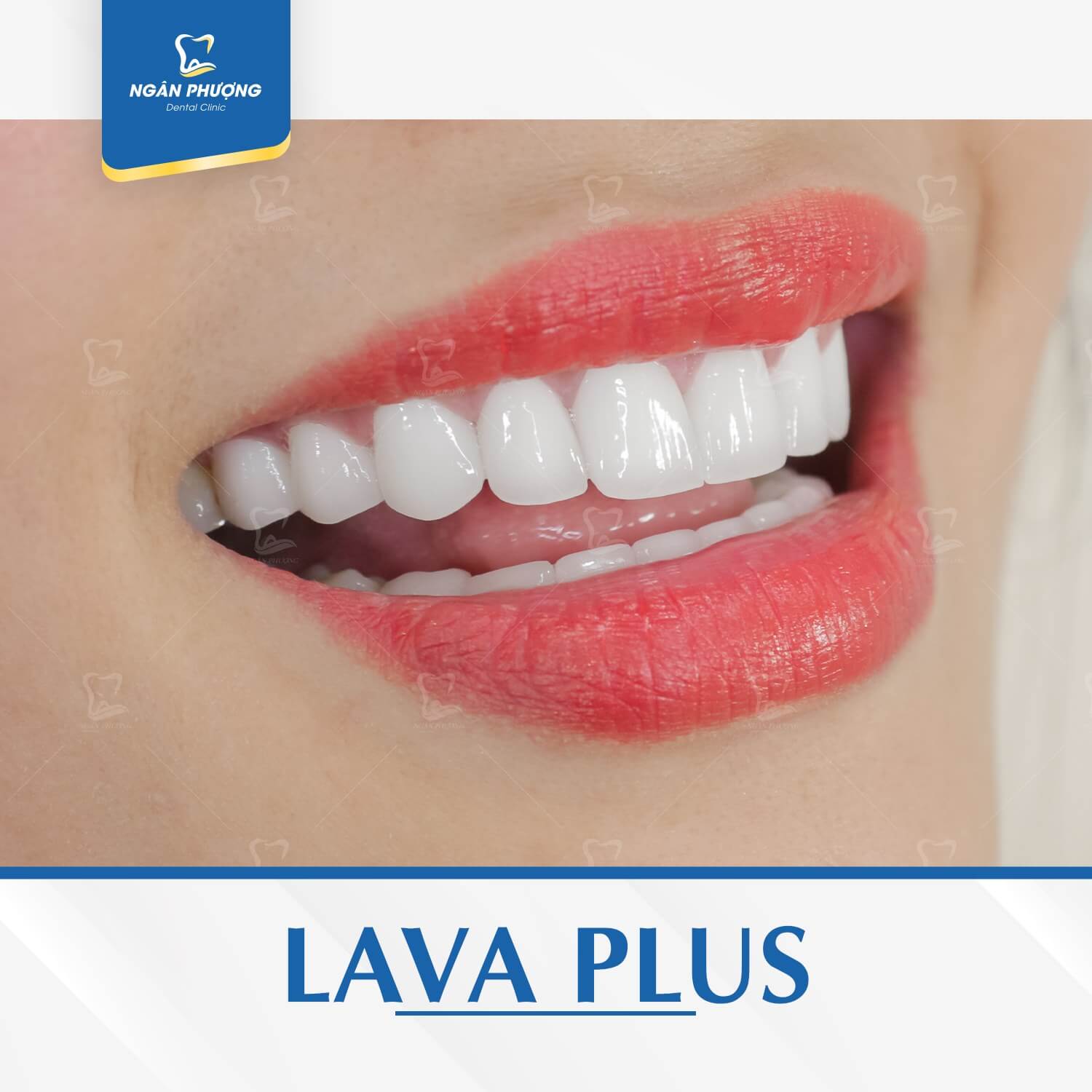 lava plus