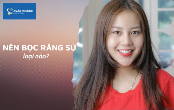 nên bọc răng sứ loại nào