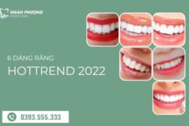 6 DÁNG RĂNG ĐẸP DẪN ĐẦU XU HƯỚNG NĂM 2025