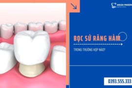 BỌC SỨ RĂNG HÀM TRONG NHỮNG TRƯỜNG HỢP NÀO?