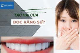5 TÁC HẠI CỦA BỌC RĂNG SỨ KHÁCH HÀNG KHÔNG NÊN XEM NHẸ!