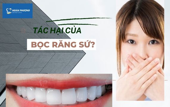 Bọc răng sứ có ảnh hưởng đến chức năng ăn nhai của người sử dụng?
