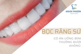 BỌC RĂNG SỨ CÓ ĂN UỐNG BÌNH THƯỜNG ĐƯỢC KHÔNG? THỰC ĐƠN HẰNG NGÀY CHO NGƯỜI BỌC RĂNG SỨ