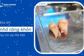 TOP 3 ĐỊA CHỈ NHỔ RĂNG KHÔN UY TÍN TẠI HÀ NỘI