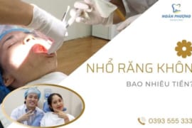 NHỔ RĂNG KHÔN BAO NHIÊU TIỀN? BẢNG GIÁ NHỔ RĂNG KHÔN CHI TIẾT 2025