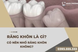 RĂNG KHÔN LÀ GÌ? CÓ NÊN NHỔ RĂNG KHÔN KHÔNG?