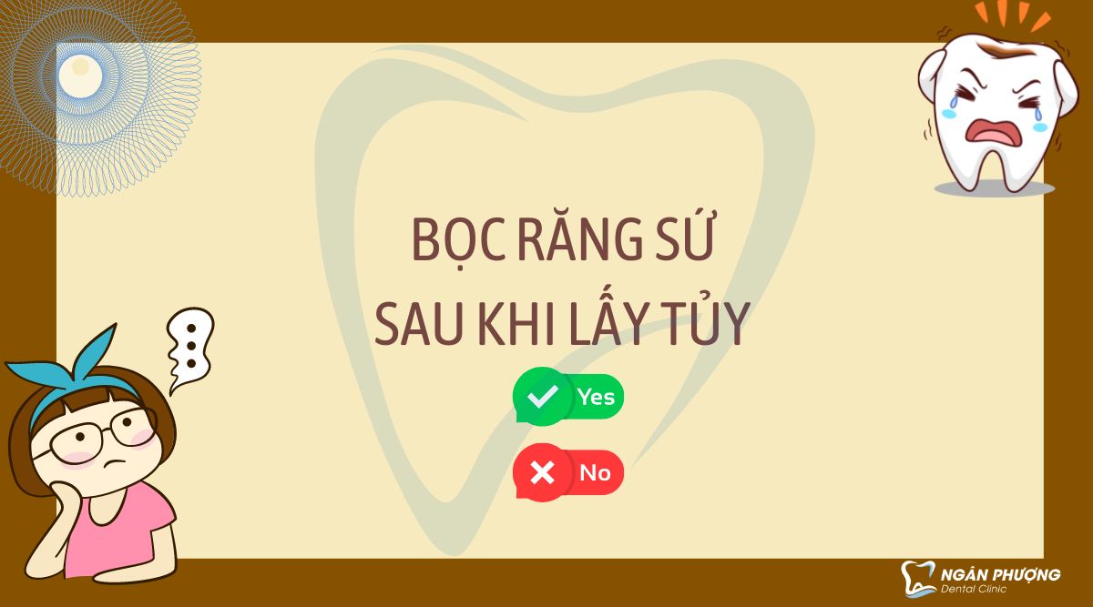 bọc răng sứ sau khi lấy tủy