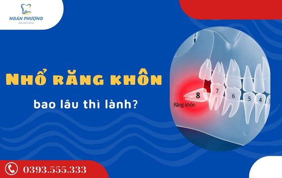 nhổ răng khôn bao lâu thì lành