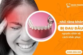 NHỔ RĂNG KHÔN BỊ ĐAU ĐẦU – NGUYÊN NHÂN VÀ CÁCH KHẮC PHỤC
