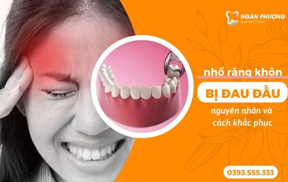 nhổ răng khôn bị đau đầu