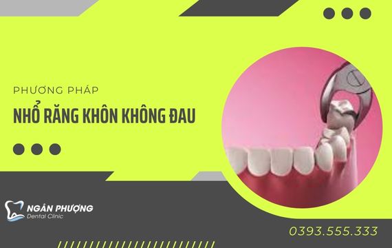 phương pháp nhổ răng khôn không đau