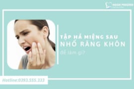 TẬP HÁ MIỆNG SAU KHI NHỔ RĂNG KHÔN ĐỂ LÀM GÌ?