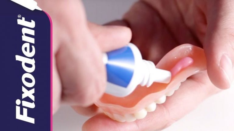 keo dán răng sứ fixodent