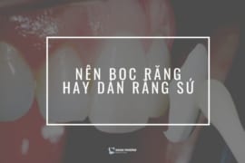BỌC SỨ HAY DÁN RĂNG SỨ? ĐÂU LÀ GIẢI PHÁP HIỆU QUẢ?