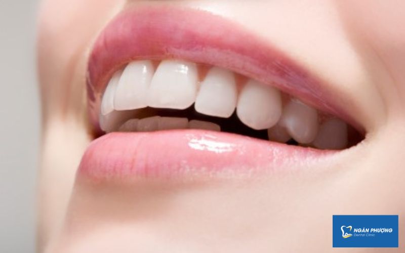 có thể là hình ảnh răng toàn sứ trên miệng một người