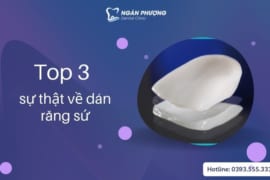 TOP 3 SỰ THẬT VỀ DÁN RĂNG SỨ CHƯA CHẮC BẠN ĐÃ BIẾT?