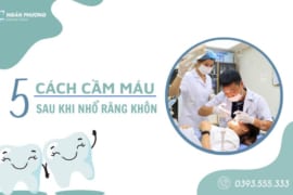 5 CÁCH CẦM MÁU SAU KHI NHỔ RĂNG KHÔN HIỆU QUẢ