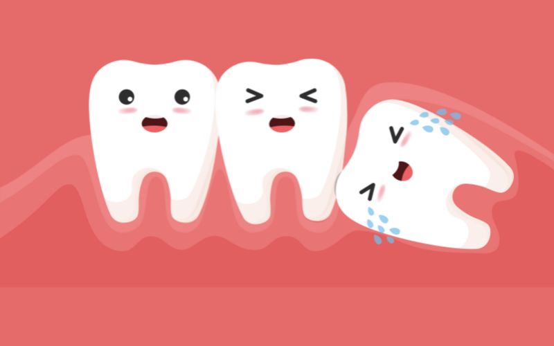 nhổ răng khôn có thực sự nguy hiểm?