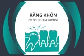 NHỔ RĂNG KHÔN CÓ NGUY HIỂM KHÔNG?