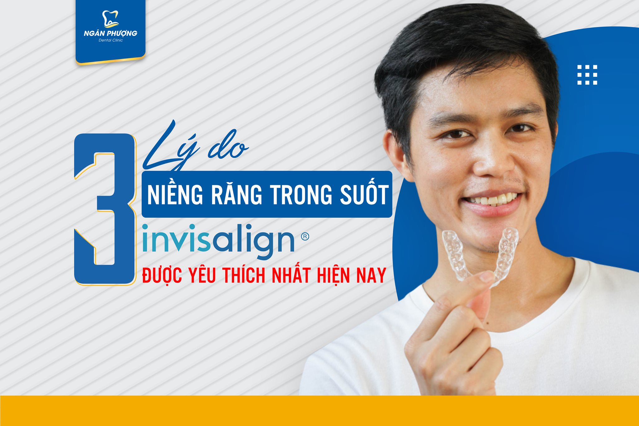 ưu điểm của niềng răng trong suốt