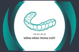 Niềng Răng Trong Suốt, Tất Tần Tật Về Công Nghệ Này