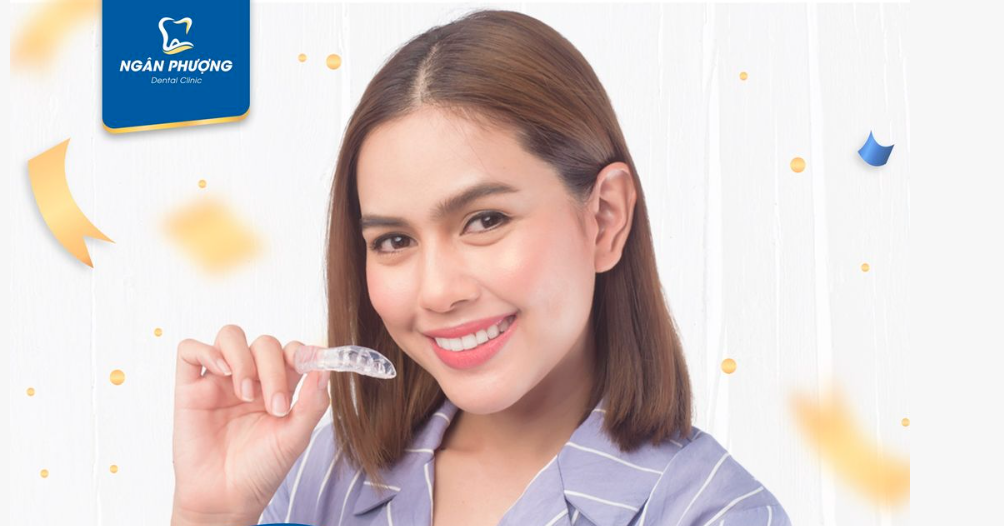 niềng răng trong suốt invisalign