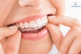 NIỀNG RĂNG TRONG SUỐT CÓ HIỆU QUẢ KHÔNG?
