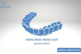 NIỀNG RĂNG TRONG SUỐT GIÁ BAO NHIÊU?
