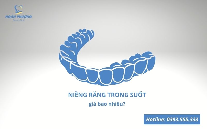 niềng răng trong suốt giá bao nhiêu