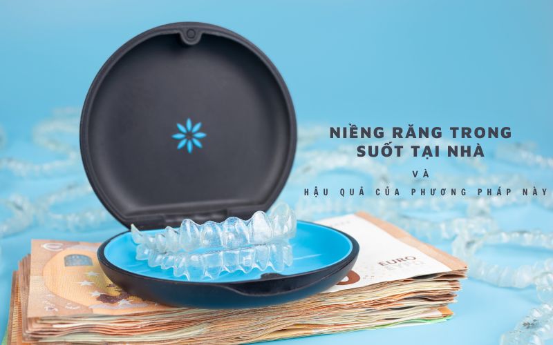 niềng răng trong suốt tại nhà