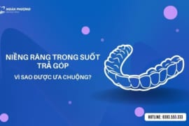 LÝ GIẢI NGUYÊN NHÂN NIỀNG RĂNG TRONG SUỐT TRẢ GÓP ĐƯỢC ƯA CHUỘNG?