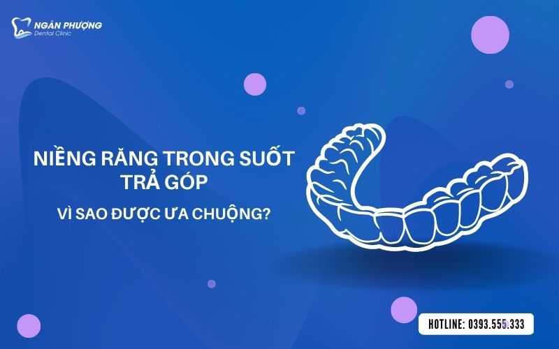 niềng răng trong suốt trả góp vì sao lại được ưa chuộng vậy?